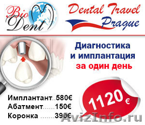 Диагностика и имплантация зубов в Праге - Изображение #1, Объявление #920449